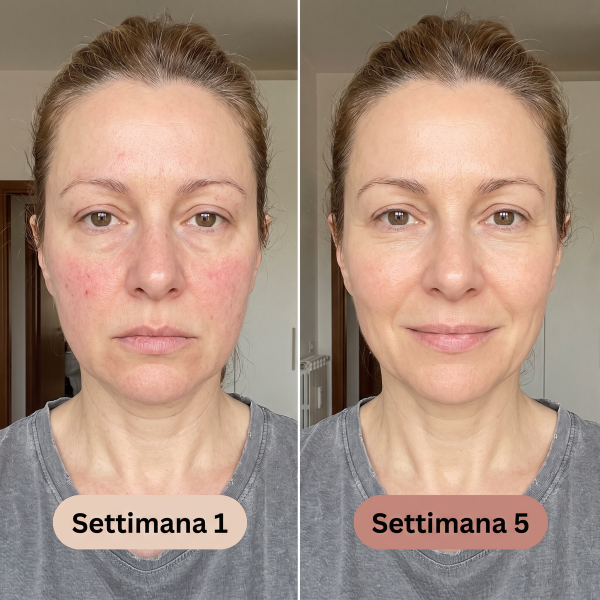 Siero Viso al Collagene Seyra